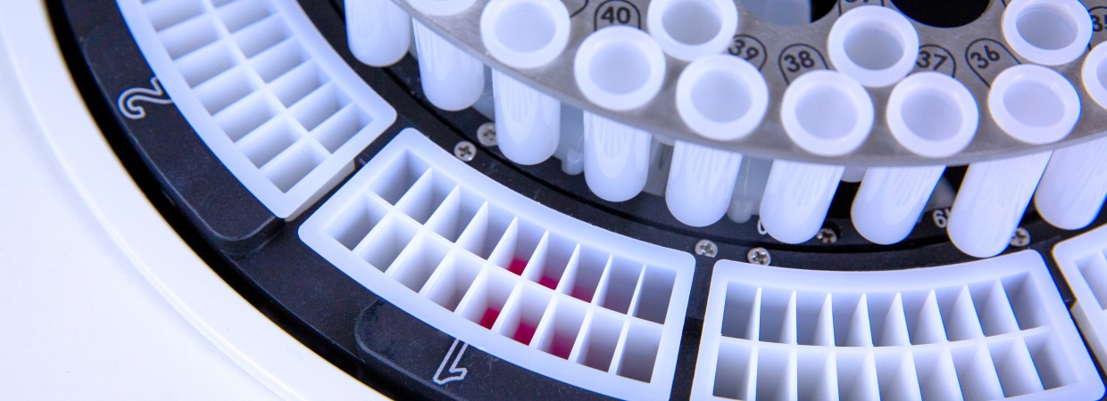 Incubation and color development